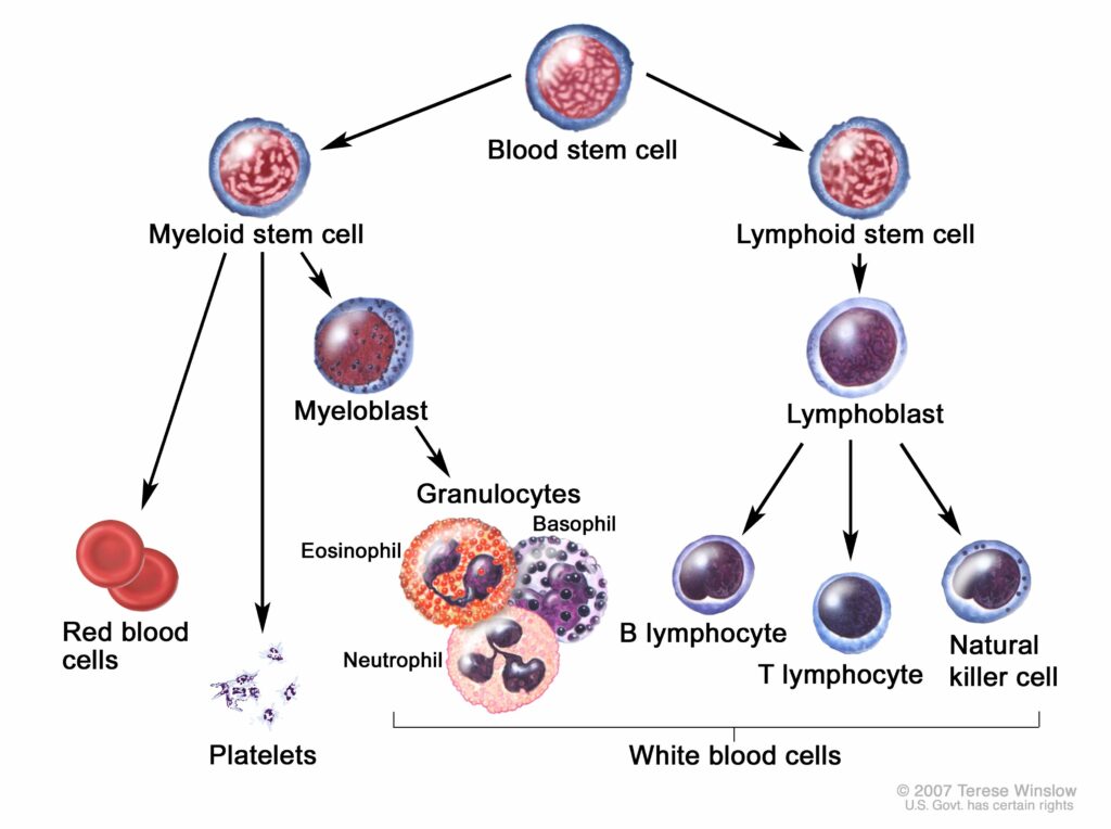 хронический лимфатический лейкоз